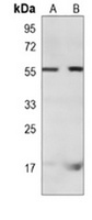 RAP1A Mouse Monoclonal Antibody