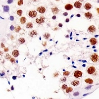 RAP1A Mouse Monoclonal Antibody