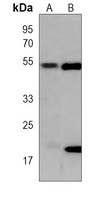 Beta1-tubulin Mouse Monoclonal Antibody
