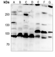 ACE2 Mouse Monoclonal Antibody