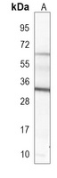 GDF15 Mouse Monoclonal Antibody