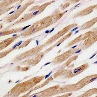 RANBP9 Mouse Monoclonal Antibody