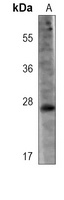 LYPD6B Mouse Monoclonal Antibody