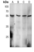 TPTE2 Mouse Monoclonal Antibody