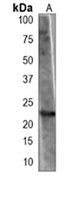 BAD (Phospho-S155) Mouse Monoclonal Antibody