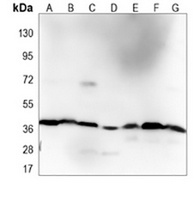 p38 Mouse Monoclonal Antibody