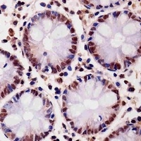 SMAD1 Mouse Monoclonal Antibody