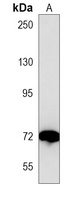 ACOX1 Mouse Monoclonal Antibody
