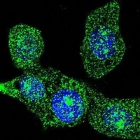 ACOX1 Mouse Monoclonal Antibody