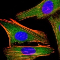 IRF3 Mouse Monoclonal Antibody