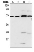 Beclin-1 Mouse Monoclonal Antibody