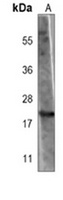 BAX Mouse Monoclonal Antibody