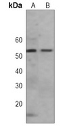 ALDH6A1 Mouse Monoclonal Antibody
