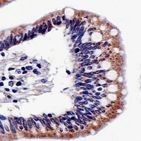 ALDH6A1 Mouse Monoclonal Antibody