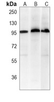 c-FER Mouse Monoclonal Antibody