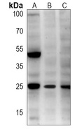 Rac 1 Mouse Monoclonal Antibody