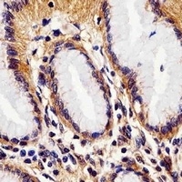Rac 1 Mouse Monoclonal Antibody