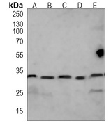RPS6 Mouse Monoclonal Antibody