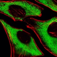 RPS6 Mouse Monoclonal Antibody
