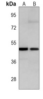 TGF beta 2 Mouse Monoclonal Antibody