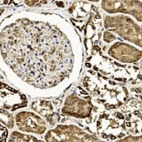 TGF beta 2 Mouse Monoclonal Antibody