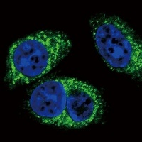TGF beta 2 Mouse Monoclonal Antibody