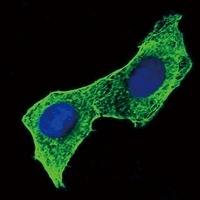 Beta-actin Mouse Monoclonal Antibody