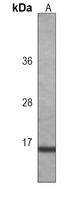 IL-2 Mouse Monoclonal Antibody