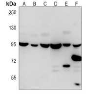 VCP Mouse Monoclonal Antibody