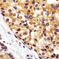 VCP Mouse Monoclonal Antibody