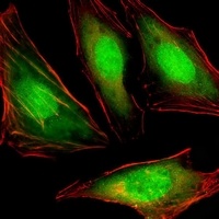 VCP Mouse Monoclonal Antibody