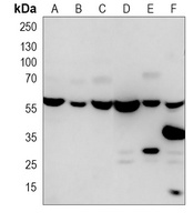 RAD23B Mouse Monoclonal Antibody