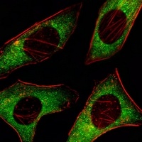 AMPK alpha 2 Mouse Monoclonal Antibody