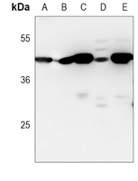 VEGFC Mouse Monoclonal Antibody
