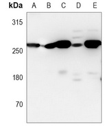 FASN Mouse Monoclonal Antibody