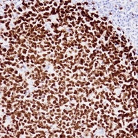 Ki67 Mouse Monoclonal Antibody