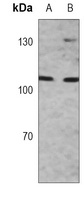 MSH2 Mouse Monoclonal Antibody