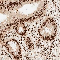 MSH2 Mouse Monoclonal Antibody