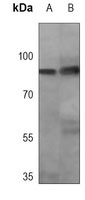 STAT1 Mouse Monoclonal Antibody