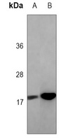 Alpha-synuclein Mouse Monoclonal Antibody