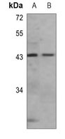 CCR7 Mouse Monoclonal Antibody