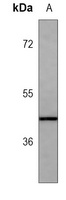 HSP47 Mouse Monoclonal Antibody