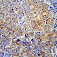HSP47 Mouse Monoclonal Antibody