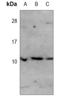 S100-A2 Mouse Monoclonal Antibody