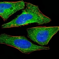 S100-A2 Mouse Monoclonal Antibody