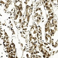 APE1 Mouse Monoclonal Antibody
