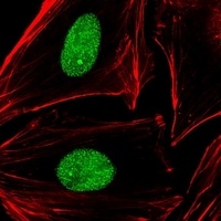APE1 Mouse Monoclonal Antibody