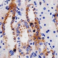 ME2 Mouse Monoclonal Antibody