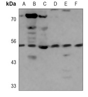 H1L Mouse Monoclonal Antibody