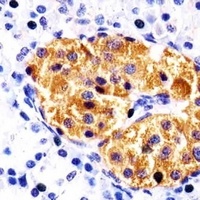 RAB3B Mouse Monoclonal Antibody